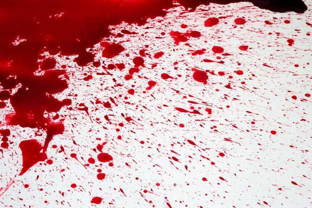 Чужая кровь в разных сонниках: