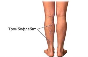 00be59a4c133d57c3672cd31c70968df.jpg