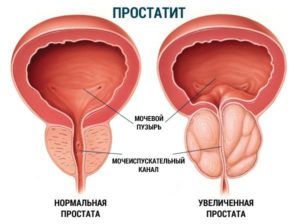 083e4f27927a02c7856e1854a8879e5a.jpg