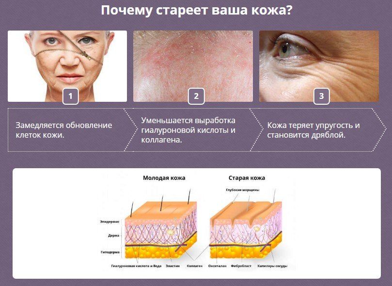 Что значит атрофические изменения. Причины регенерации кожи. Старение кожи. Старение кожи дерматология. Возрастные изменения кожи.