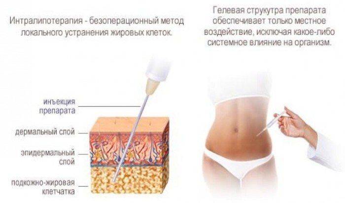 40fe42acca592a6cc976034c387a58c2.jpg