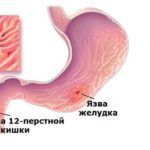 7bbf9a08d524fc14ca1fdd3d55265b3d.jpg