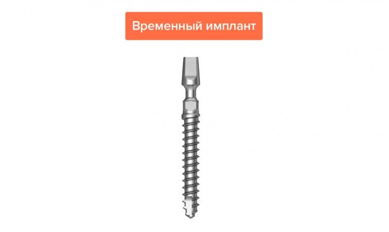 83f53dc16b753eb303d2b1a080f5cc85.jpg