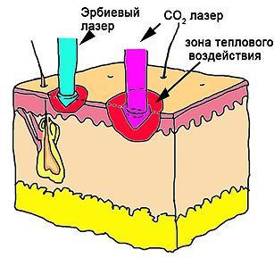 b6e799cf4e732e51e061f25d611d3e8f.jpg