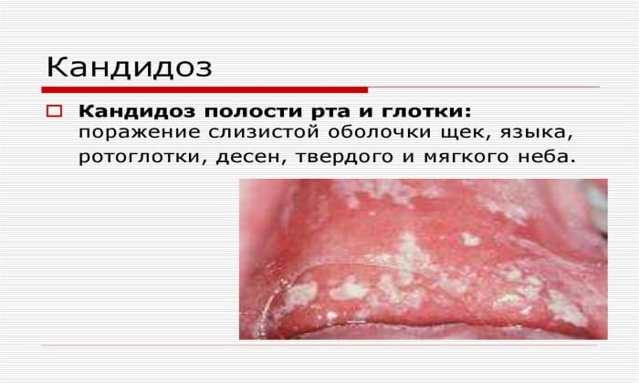 b7fc961073c0dbf558a51d1b4d271fa6.jpg