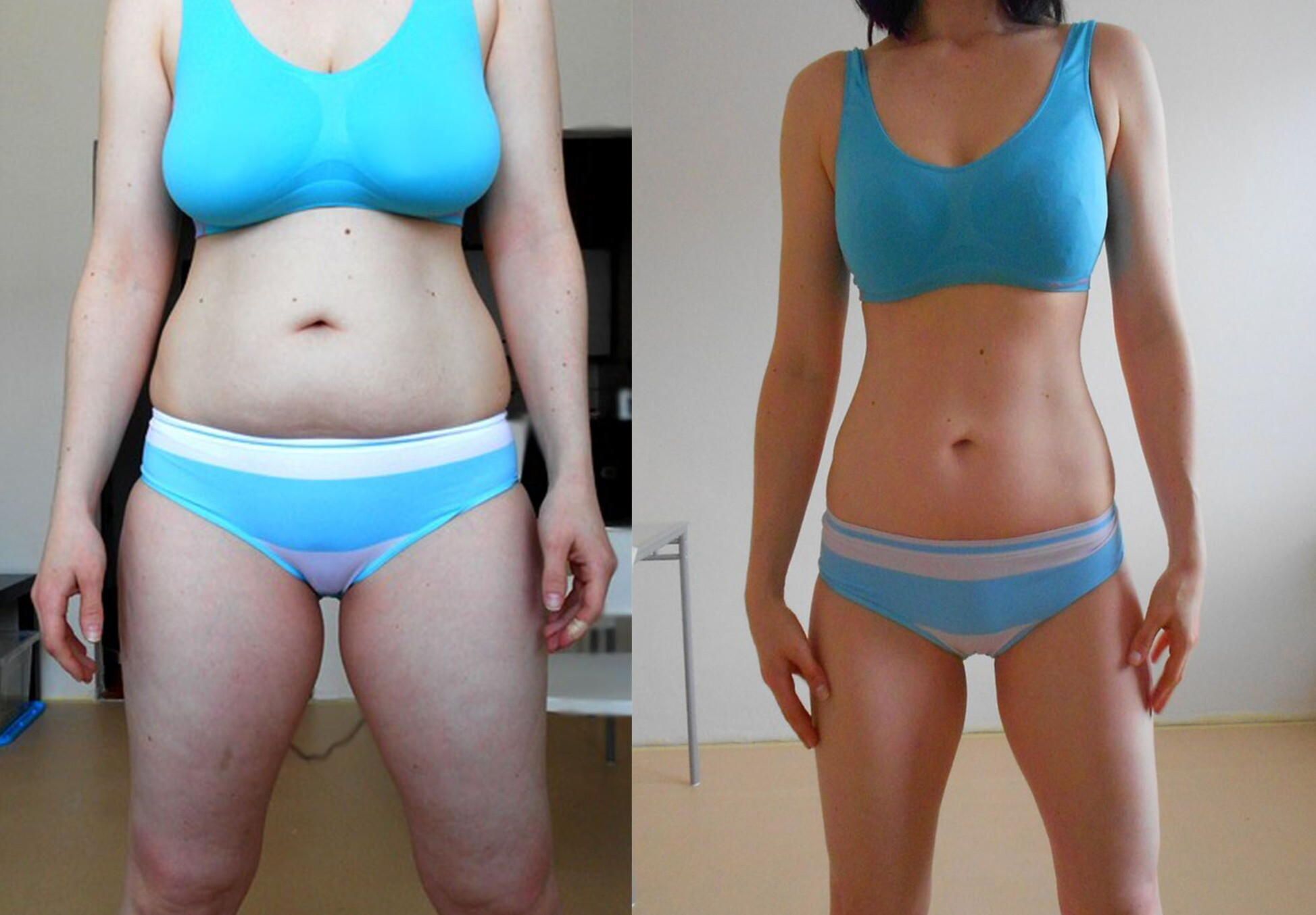 Тело стало мягкое. Фигура до и после. Живот до и после похудения. Фигура до и после занятий. Фигура до и после похудения.