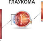 c1ffd4fce5022e299a701302cadc93f1.png
