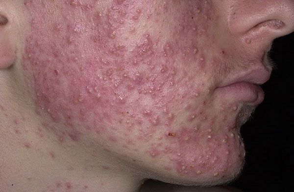 ccf411cafc30c8eab7472ccb3808e16f.jpg