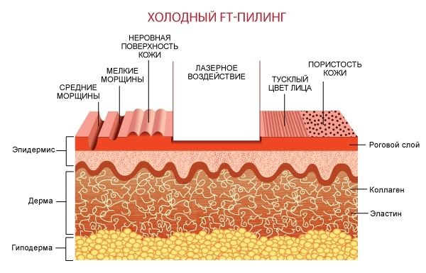dfcb30190fd33d35443e9c80476415f7.jpg