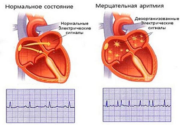 e865f61c82dafae014bf609306609399.jpg