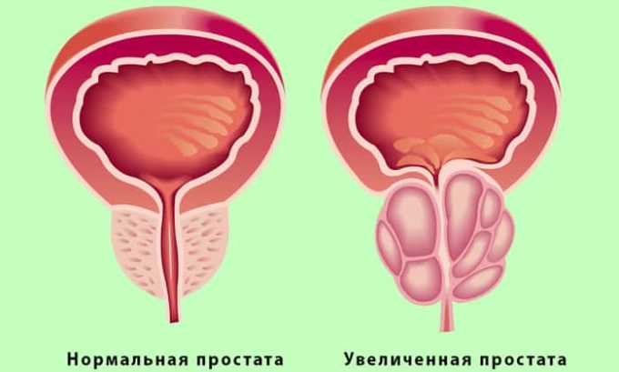 ec3c71d0f601d0f6ffc12b2e22357fba.jpg