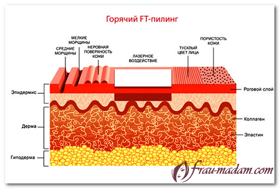 f7c7d237402b0a8e03e95a539cee6a6d.png